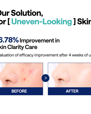 Madecassoside Pad - [brand_name]