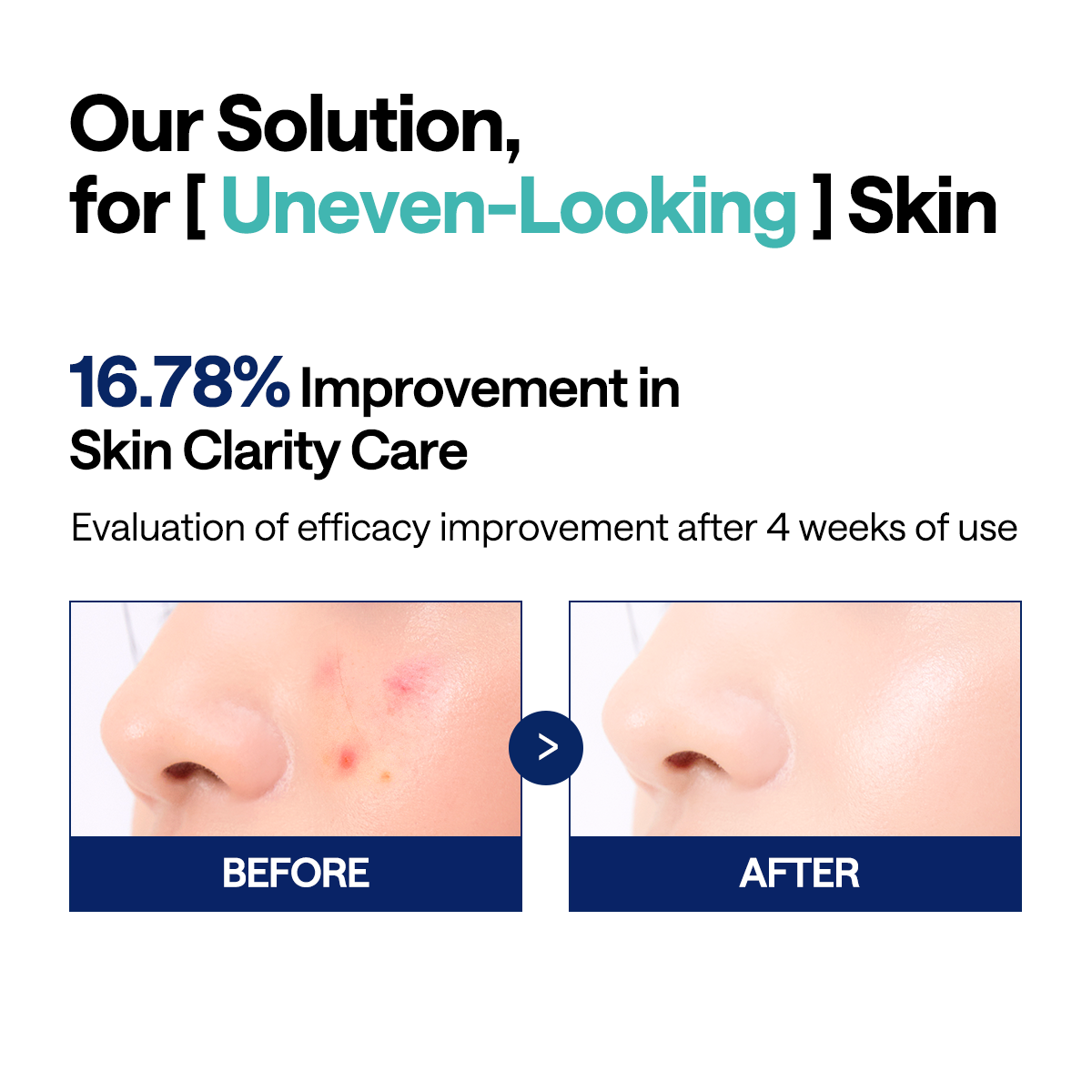 Madecassoside Pad - [brand_name]