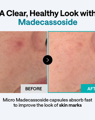 Derma Cream Madecassoside Blemish Repair