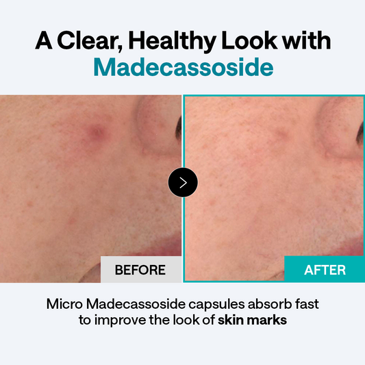 Derma Cream Madecassoside Blemish Repair