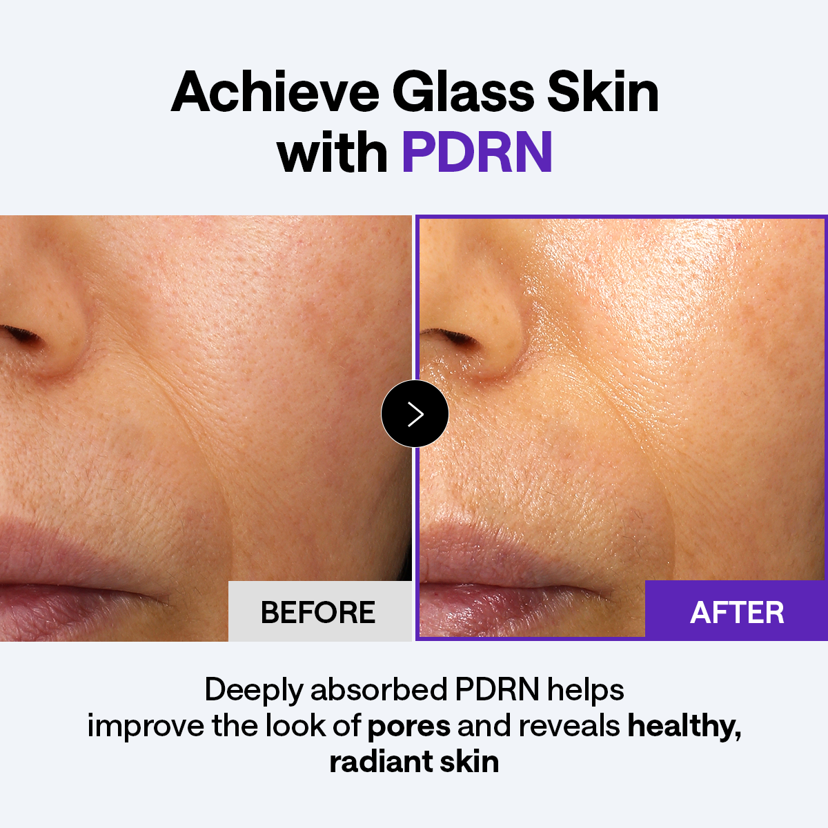 Derma Cream PDRN Lifting