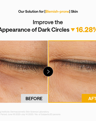 Vitamin C Brightening Capsule Eye Patch