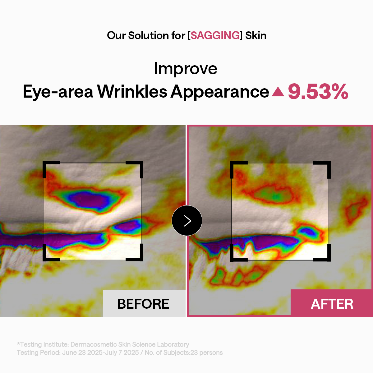 Retinol Lifting Capsule Eye Patch
