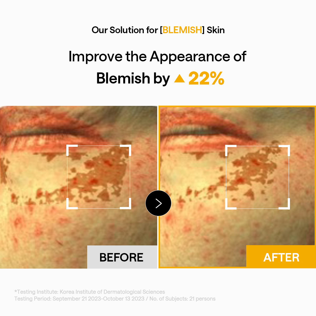 Vita Collagen Eye Ampoule Patch - [brand_name]
