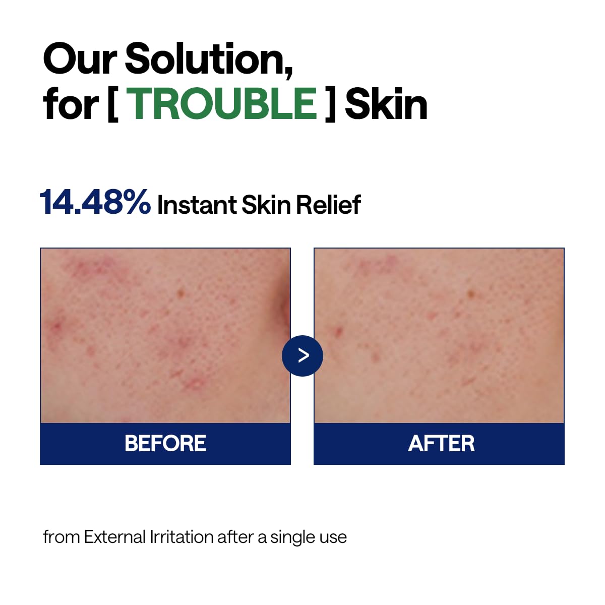 Teatree Calming Hydra Serum - [brand_name]