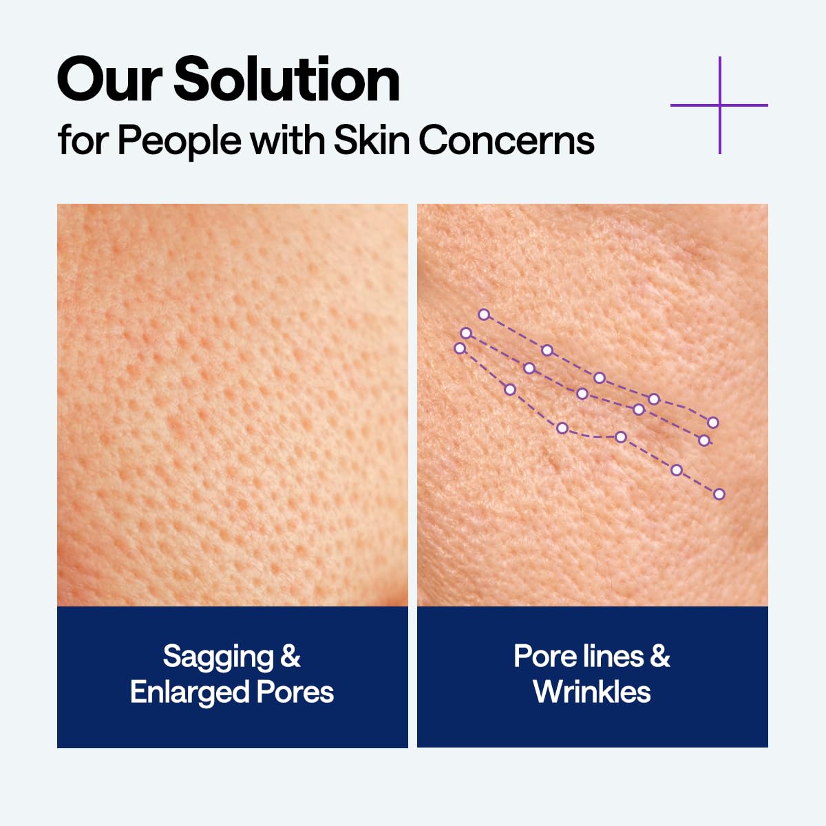 PDRN Lifting Serum - [brand_name]