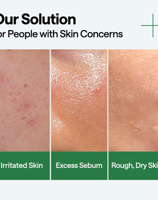 Teatree Calming Hydra Serum - [brand_name]