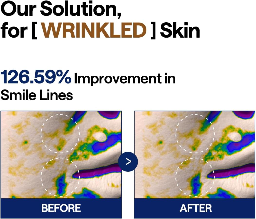 Retinol Collagen Lifting Pad - [brand_name]