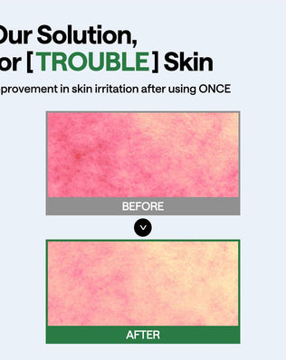 Teatree Wrapping Serum Mask - [brand_name]