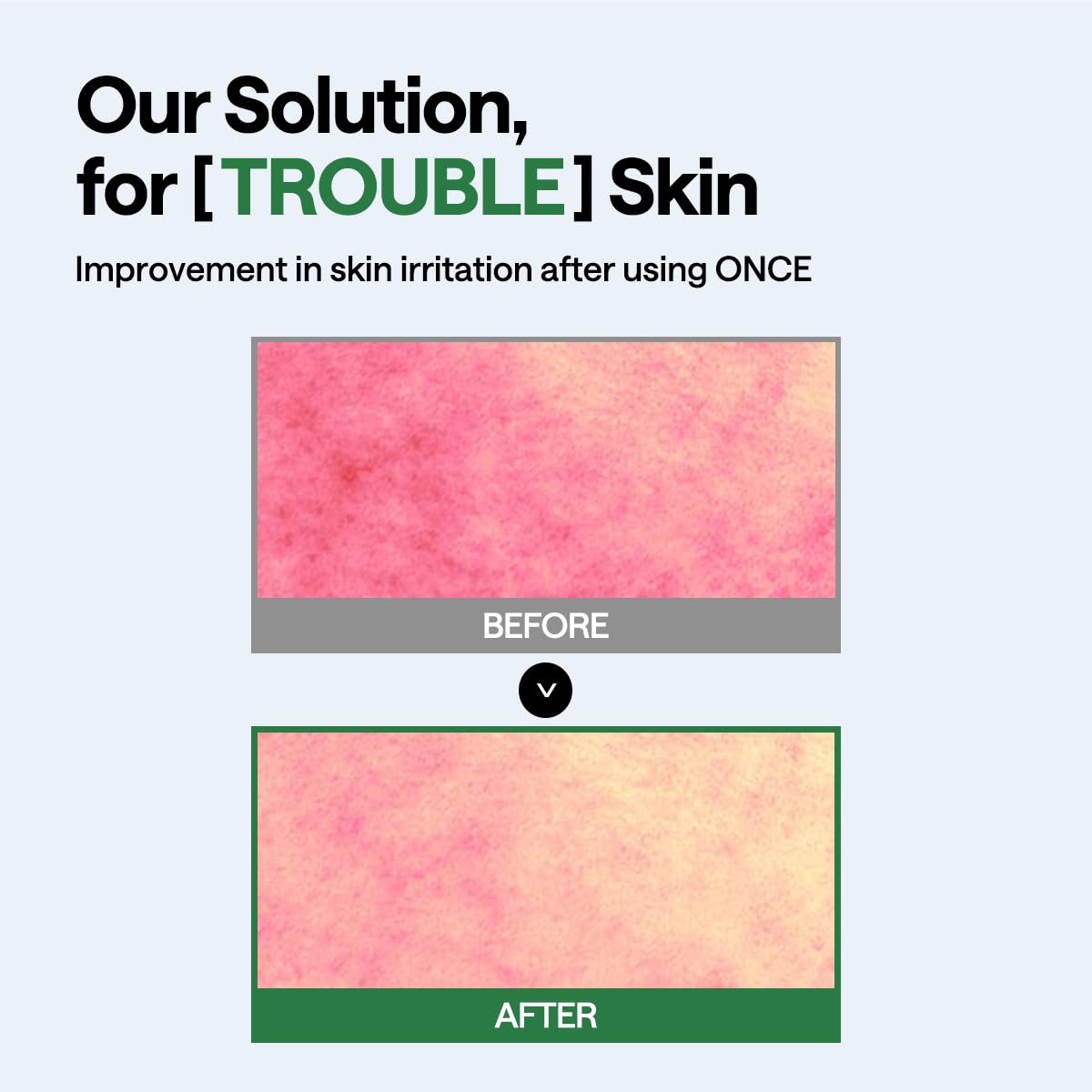 Teatree Wrapping Serum Mask - [brand_name]