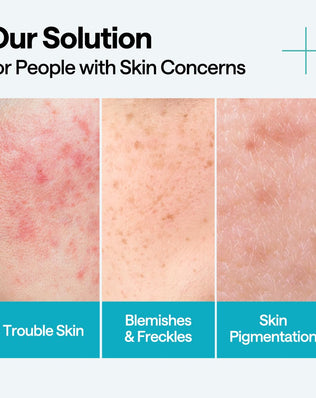 Madecassoside Blemish Repair Serum - [brand_name]