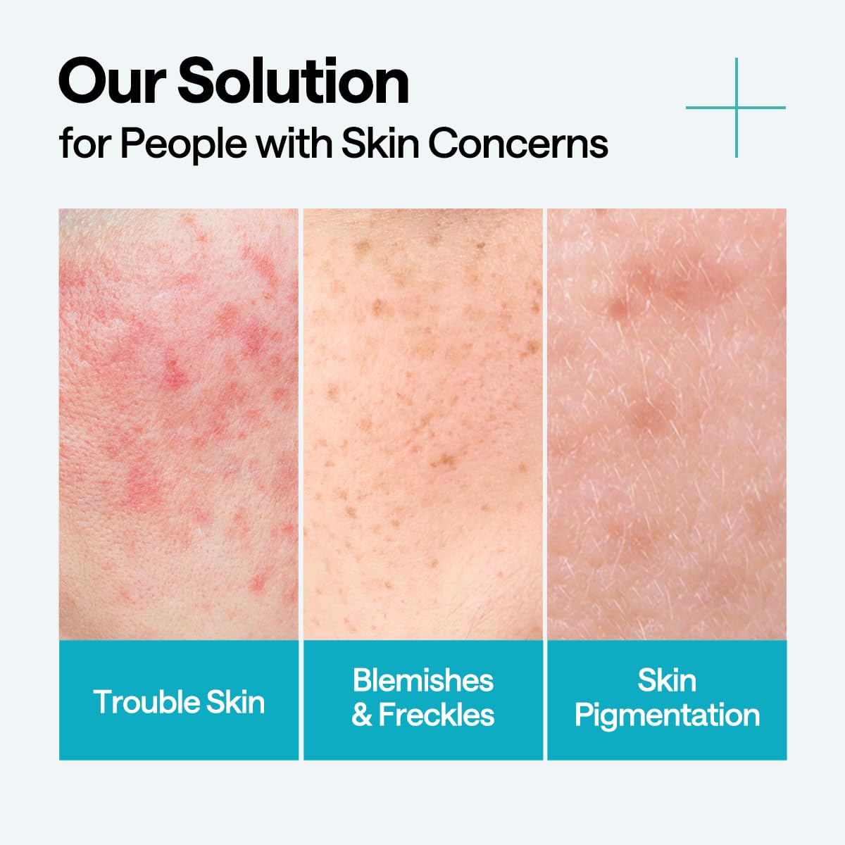 Madecassoside Blemish Repair Serum - [brand_name]