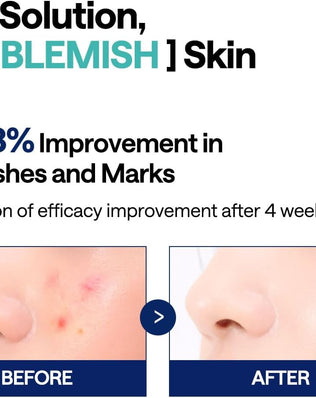 Madecassoside Blemish Pad - [brand_name]