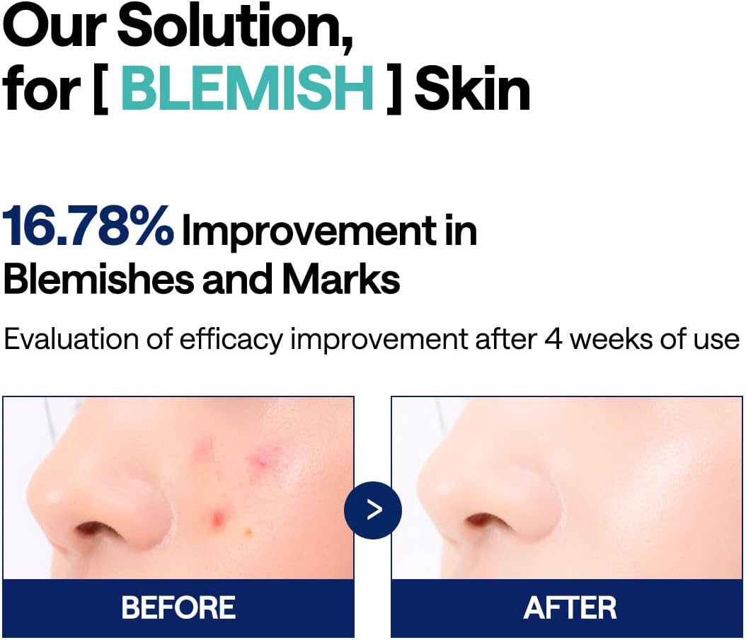 Madecassoside Blemish Pad - [brand_name]