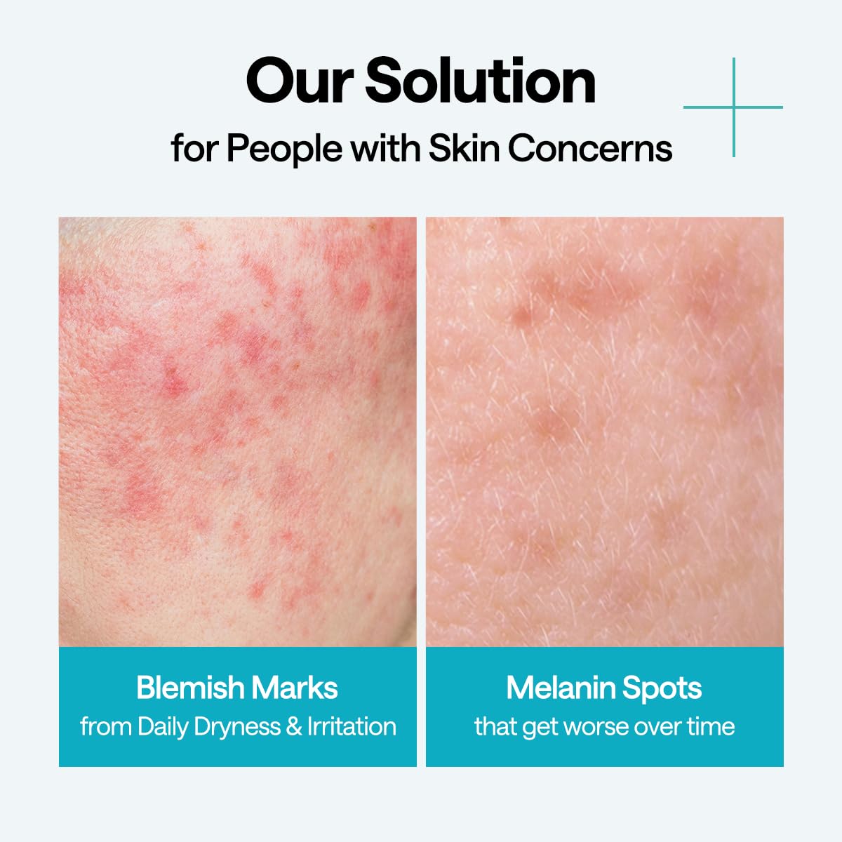 Mediheal Madecassoside Wrapping Serum Mask - [brand_name]