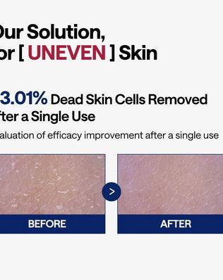 Phyto-enzyme Peeling Pad - [brand_name]