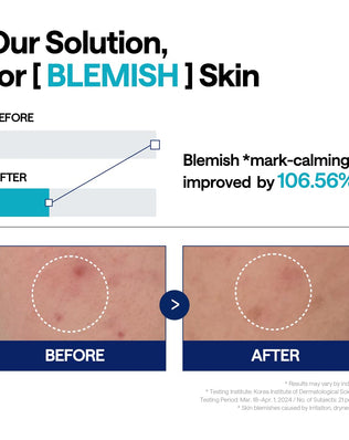 Madecassoside Blemish Repair Serum - [brand_name]