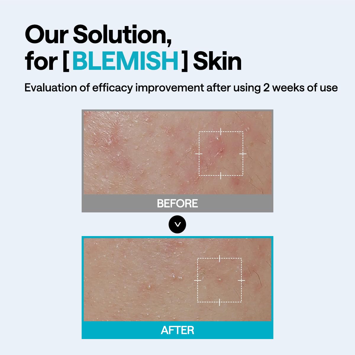 Mediheal Madecassoside Wrapping Serum Mask - [brand_name]