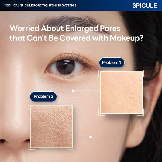 Spicule Pore Tightening System 1 - [brand_name]
