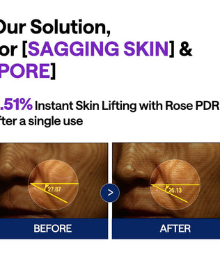 PDRN Lifting Serum - [brand_name]