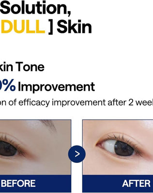 Vitamide Brightening Pad - [brand_name]