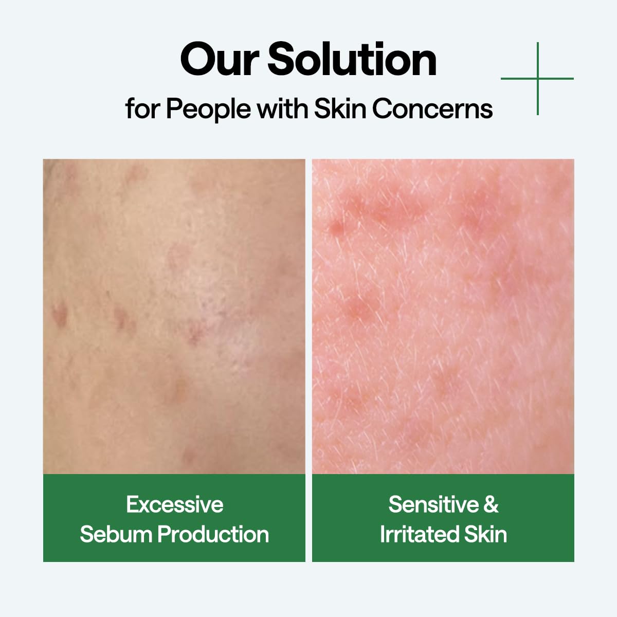 Teatree Wrapping Serum Mask - [brand_name]
