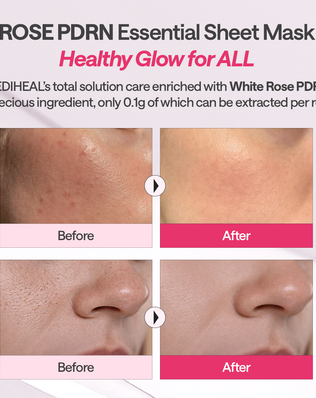 Rose PDRN Essential Mask Healthy Glow
